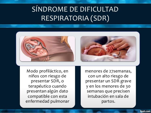 sindrome de dificultad respiratoria del recien nacido